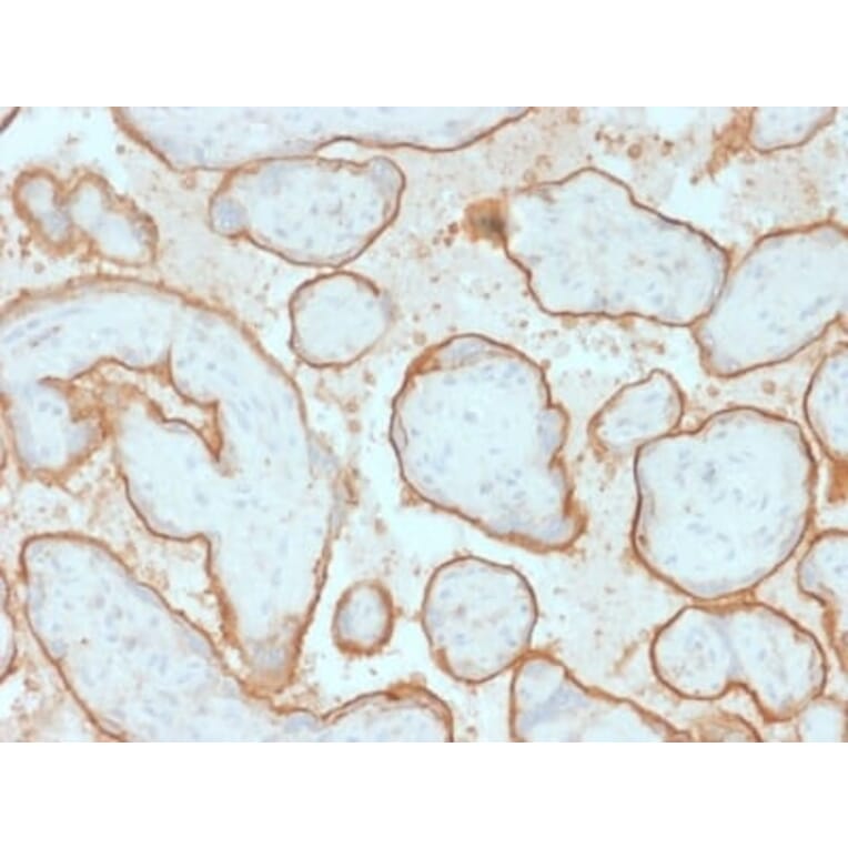 Immunohistochemistry (formalin-fixed, paraffin-embedded) - Anti-EGFR Antibody [GFR/2341] (CF®488A) (A353890) - Antibodies.com