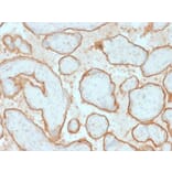 Immunohistochemistry (formalin-fixed, paraffin-embedded) - Anti-EGFR Antibody [GFR/2341] (CF®488A) (A353890) - Antibodies.com