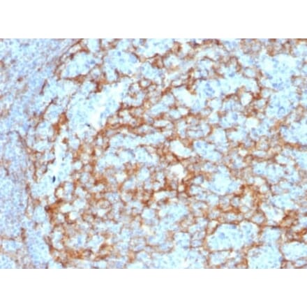 Immunohistochemistry (formalin-fixed, paraffin-embedded) - Anti-CD14 Antibody [LPSR/2385] (CF®405S) (A353909) - Antibodies.com