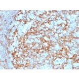 Immunohistochemistry (formalin-fixed, paraffin-embedded) - Anti-CD14 Antibody [LPSR/2385] (CF®405S) (A353909) - Antibodies.com