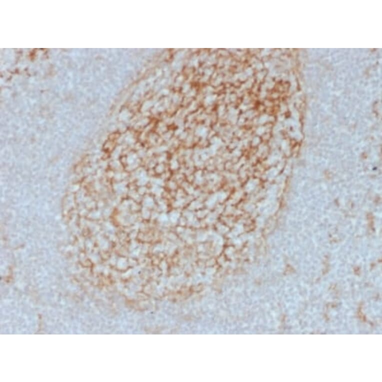 Immunohistochemistry (formalin-fixed, paraffin-embedded) - Anti-CD14 Antibody [LPSR/2385] (CF®647) (A353911) - Antibodies.com
