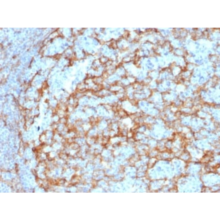 Immunohistochemistry (formalin-fixed, paraffin-embedded) - Anti-CD14 Antibody [LPSR/2385] (CF®568) (A353912) - Antibodies.com