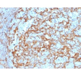 Immunohistochemistry (formalin-fixed, paraffin-embedded) - Anti-CD14 Antibody [LPSR/2385] (CF®488A) (A353914) - Antibodies.com