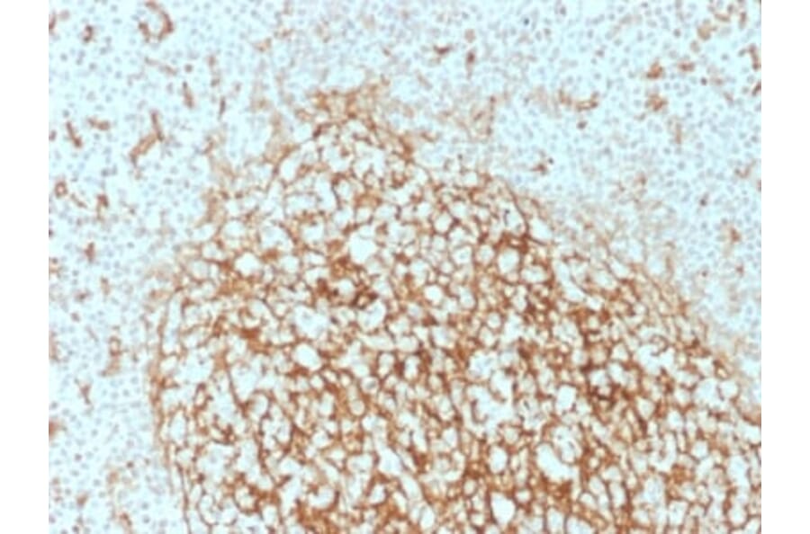 Immunohistochemistry (formalin-fixed, paraffin-embedded) - Anti-CD14 Antibody [LPSR/2386] (CF®405S) (A353917) - Antibodies.com