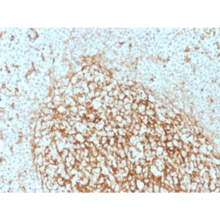 Immunohistochemistry (formalin-fixed, paraffin-embedded) - Anti-CD14 Antibody [LPSR/2386] (CF®405S) (A353917) - Antibodies.com