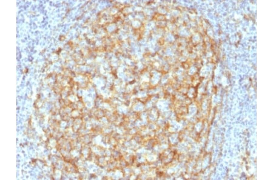Immunohistochemistry (formalin-fixed, paraffin-embedded) - Anti-CD14 Antibody [LPSR/2386] (CF®568) (A353920) - Antibodies.com
