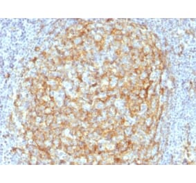 Immunohistochemistry (formalin-fixed, paraffin-embedded) - Anti-CD14 Antibody [LPSR/2386] (CF®488A) (A353922) - Antibodies.com