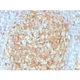 Immunohistochemistry (formalin-fixed, paraffin-embedded) - Anti-CD14 Antibody [LPSR/2386] (CF®488A) (A353922) - Antibodies.com