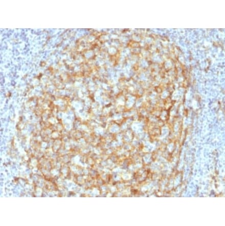 Immunohistochemistry (formalin-fixed, paraffin-embedded) - Anti-CD14 Antibody [LPSR/2386] (Biotin) (A353924) - Antibodies.com