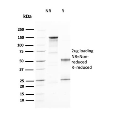 SDS-PAGE - Anti-CD25 Antibody [IL2RA/2394] (CF®647) (A353927) - Antibodies.com