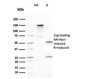 SDS-PAGE - Anti-CD25 Antibody [IL2RA/2394] (CF®594) (A353931) - Antibodies.com