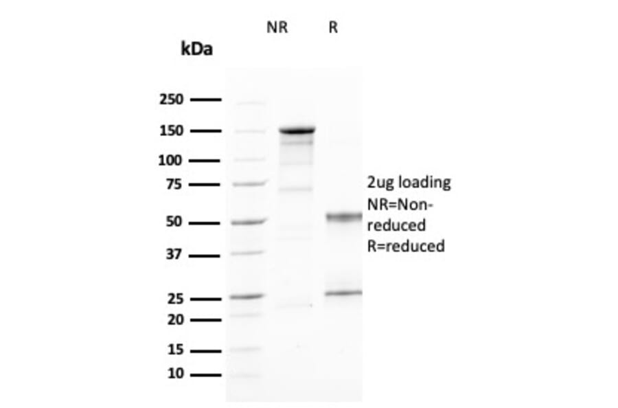 SDS-PAGE - Anti-CD25 Antibody [IL2RA/2394] (CF®594) (A353931) - Antibodies.com
