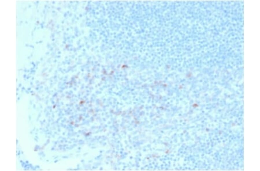 Immunohistochemistry (formalin-fixed, paraffin-embedded) - Anti-CD25 Antibody [IL2RA/2395] (CF®640R) (A353934) - Antibodies.com