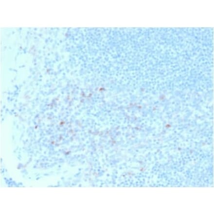 Immunohistochemistry (formalin-fixed, paraffin-embedded) - Anti-CD25 Antibody [IL2RA/2395] (CF®640R) (A353934) - Antibodies.com