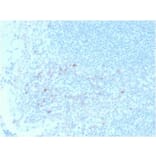 Immunohistochemistry (formalin-fixed, paraffin-embedded) - Anti-CD25 Antibody [IL2RA/2395] (CF®647) (A353935) - Antibodies.com