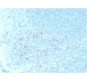 Immunohistochemistry (formalin-fixed, paraffin-embedded) - Anti-CD25 Antibody [IL2RA/2395] (CF®740) (A353937) - Antibodies.com