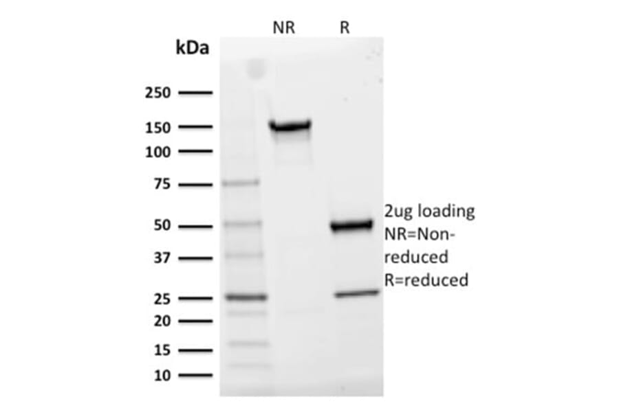 SDS-PAGE - Anti-CD25 Antibody [IL2RA/2395] (CF®740) (A353937) - Antibodies.com