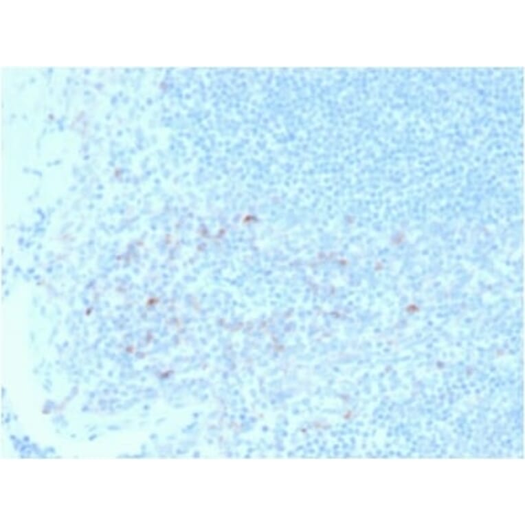 Immunohistochemistry (formalin-fixed, paraffin-embedded) - Anti-CD25 Antibody [IL2RA/2395] (CF®594) (A353939) - Antibodies.com