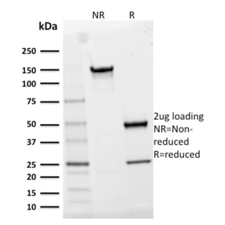 SDS-PAGE - Anti-CD25 Antibody [IL2RA/2395] (Biotin) (A353940) - Antibodies.com