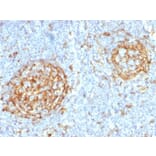 Immunohistochemistry (formalin-fixed, paraffin-embedded) - Anti-CD14 Antibody [LPSR/2397] (CF®405S) (A353941) - Antibodies.com
