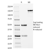 SDS-PAGE - Anti-CD14 Antibody [LPSR/2397] (CF®405S) (A353941) - Antibodies.com