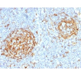 Immunohistochemistry (formalin-fixed, paraffin-embedded) - Anti-CD14 Antibody [LPSR/2397] (CF®488A) (A353946) - Antibodies.com
