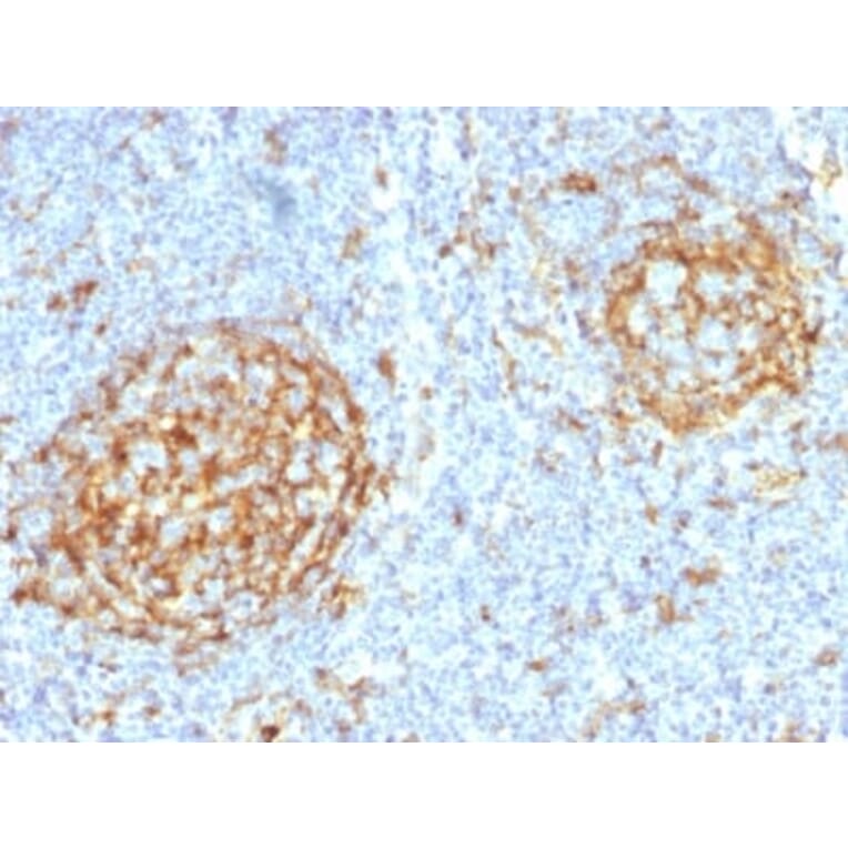 Immunohistochemistry (formalin-fixed, paraffin-embedded) - Anti-CD14 Antibody [LPSR/2397] (CF®488A) (A353946) - Antibodies.com
