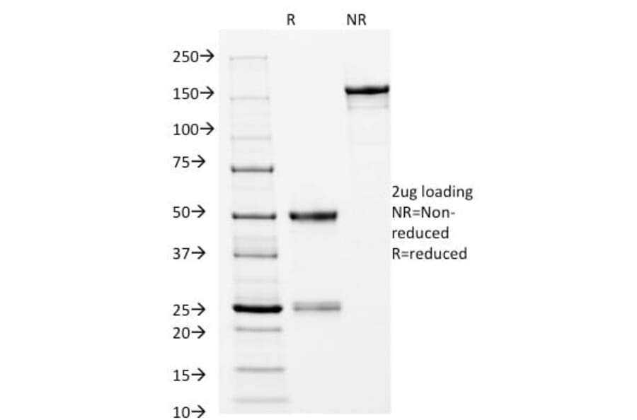 SDS-PAGE - Anti-CD14 Antibody [LPSR/2397] (CF®488A) (A353946) - Antibodies.com