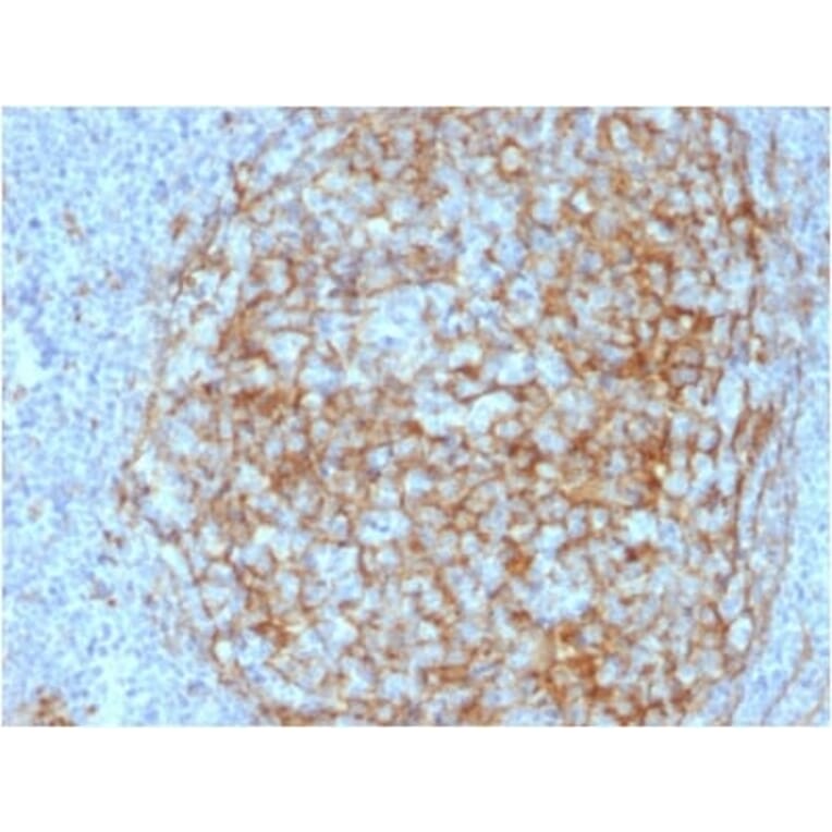 Immunohistochemistry (formalin-fixed, paraffin-embedded) - Anti-CD14 Antibody [LPSR/2408] (CF®740) (A353953) - Antibodies.com