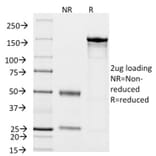 SDS-PAGE - Anti-CD14 Antibody [LPSR/2408] (CF®740) (A353953) - Antibodies.com