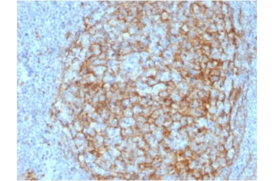 Immunohistochemistry (formalin-fixed, paraffin-embedded) - Anti-CD14 Antibody [LPSR/2408] (CF®488A) (A353954) - Antibodies.com