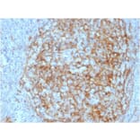 Immunohistochemistry (formalin-fixed, paraffin-embedded) - Anti-CD14 Antibody [LPSR/2408] (CF®488A) (A353954) - Antibodies.com