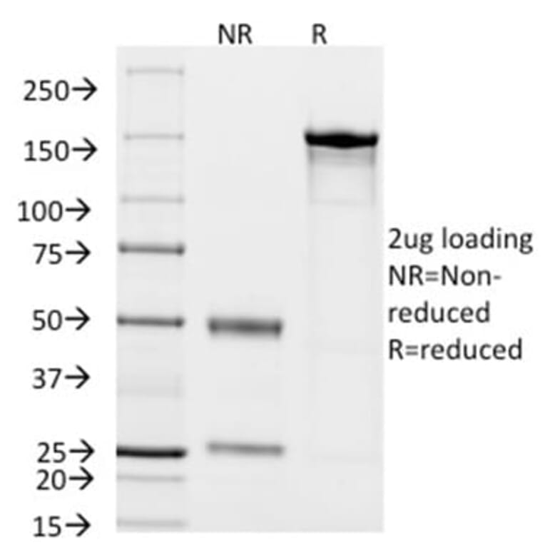 SDS-PAGE - Anti-CD14 Antibody [LPSR/2408] (CF®488A) (A353954) - Antibodies.com