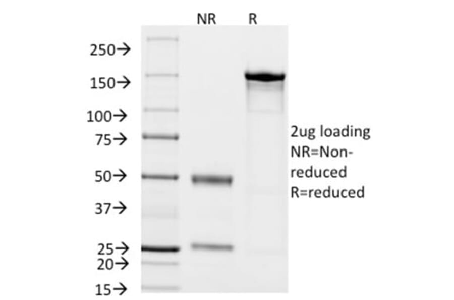 SDS-PAGE - Anti-CD14 Antibody [LPSR/2408] (CF®594) (A353955) - Antibodies.com