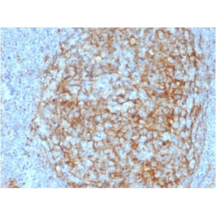 Immunohistochemistry (formalin-fixed, paraffin-embedded) - Anti-CD14 Antibody [LPSR/2408] (Biotin) (A353956) - Antibodies.com