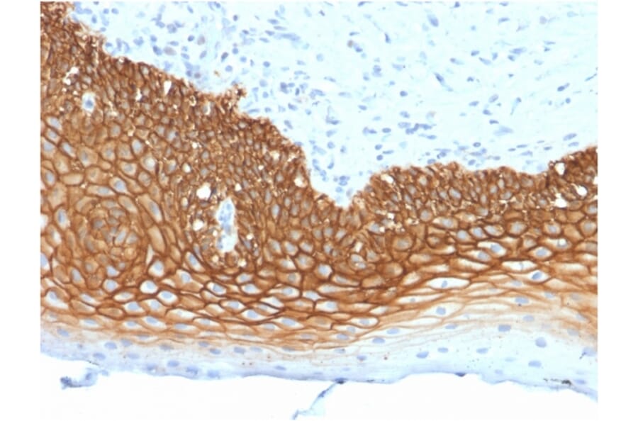 Immunohistochemistry (formalin-fixed, paraffin-embedded) - Anti-CD44v3 Antibody [3G5] (CF®594) (A353963) - Antibodies.com