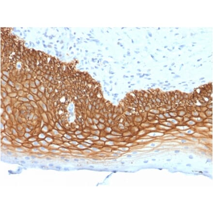 Immunohistochemistry (formalin-fixed, paraffin-embedded) - Anti-CD44v3 Antibody [3G5] (CF®594) (A353963) - Antibodies.com