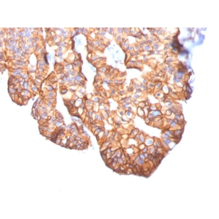 Immunohistochemistry (formalin-fixed, paraffin-embedded) - Anti-ErbB2 Antibody [ERBB2/2452] (CF®405S) (A353965) - Antibodies.com