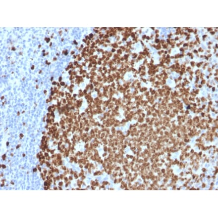 Immunohistochemistry (formalin-fixed, paraffin-embedded) - Anti-Ki67 Antibody [MKI67/2461] (CF®405S) (A353973) - Antibodies.com