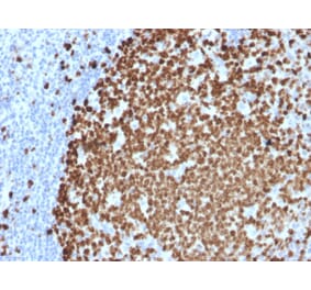 Immunohistochemistry (formalin-fixed, paraffin-embedded) - Anti-Ki67 Antibody [MKI67/2461] (CF®640R) (A353974) - Antibodies.com