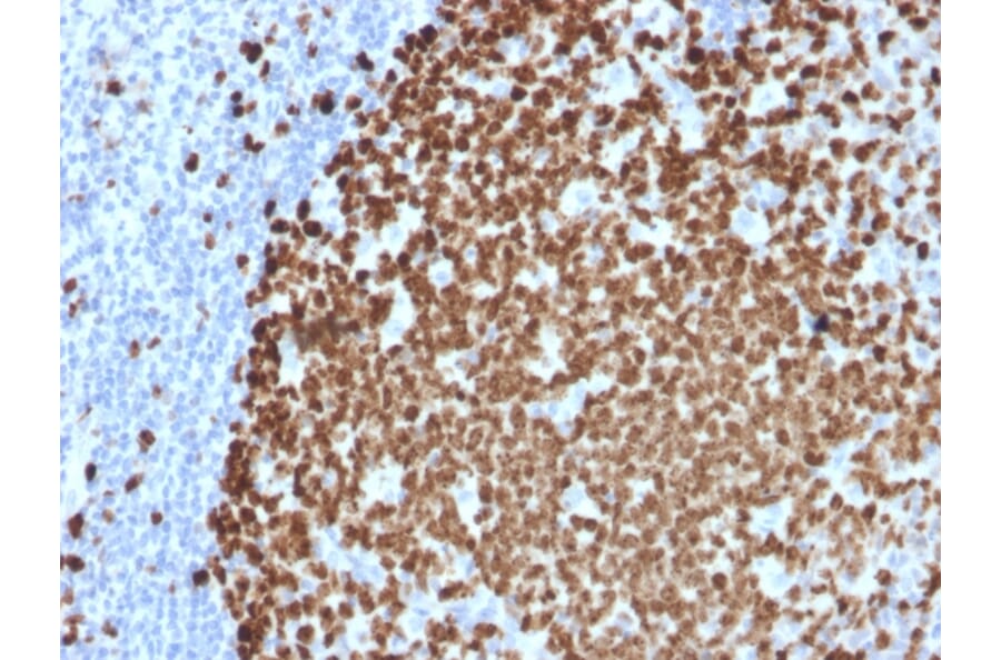 Immunohistochemistry (formalin-fixed, paraffin-embedded) - Anti-Ki67 Antibody [MKI67/2461] (CF®568) (A353976) - Antibodies.com