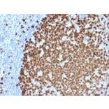 Immunohistochemistry (formalin-fixed, paraffin-embedded) - Anti-Ki67 Antibody [MKI67/2461] (CF®594) (A353979) - Antibodies.com
