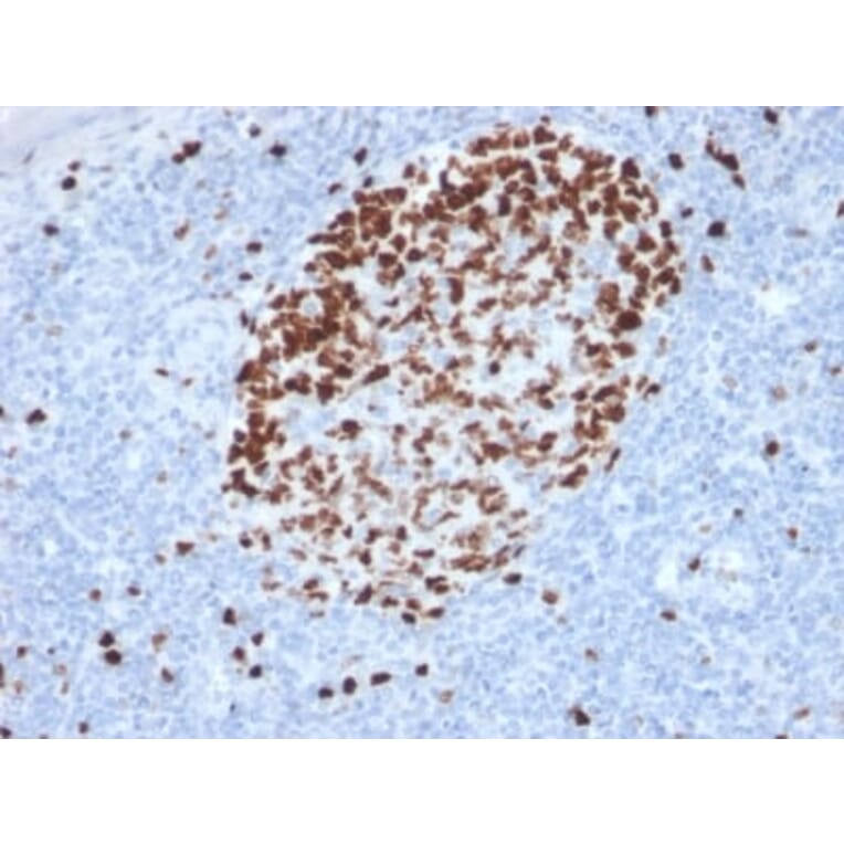 Immunohistochemistry (formalin-fixed, paraffin-embedded) - Anti-Ki67 Antibody [MKI67/2462] (CF®405S) (A353981) - Antibodies.com