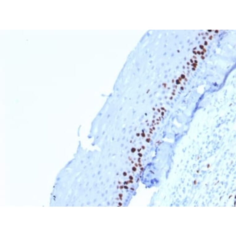 Immunohistochemistry (formalin-fixed, paraffin-embedded) - Anti-Ki67 Antibody [MKI67/2462] (CF®640R) (A353982) - Antibodies.com