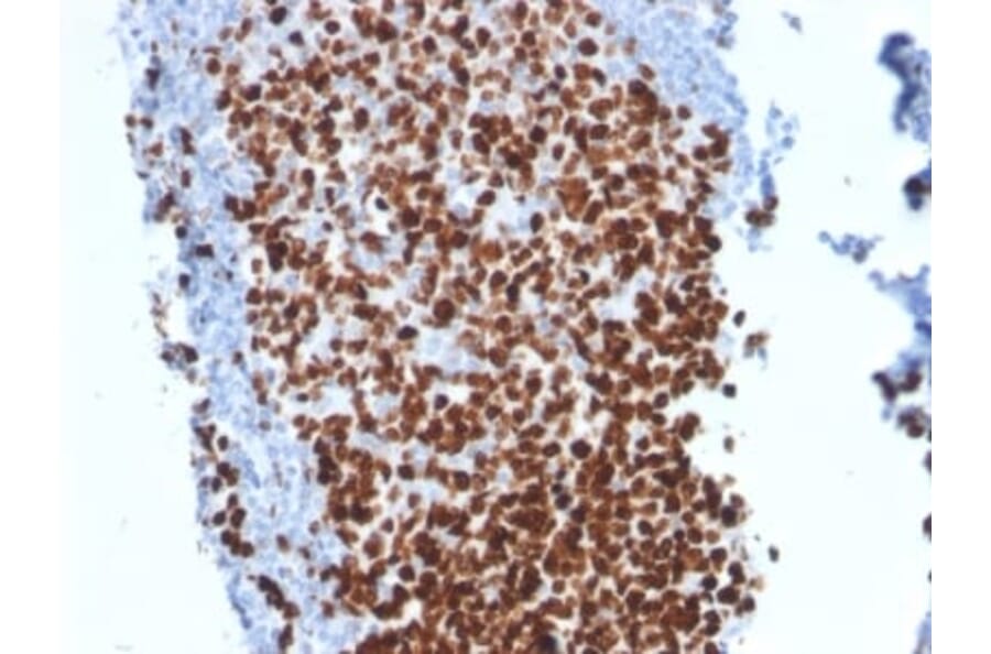 Immunohistochemistry (formalin-fixed, paraffin-embedded) - Anti-Ki67 Antibody [MKI67/2462] (CF®568) (A353984) - Antibodies.com
