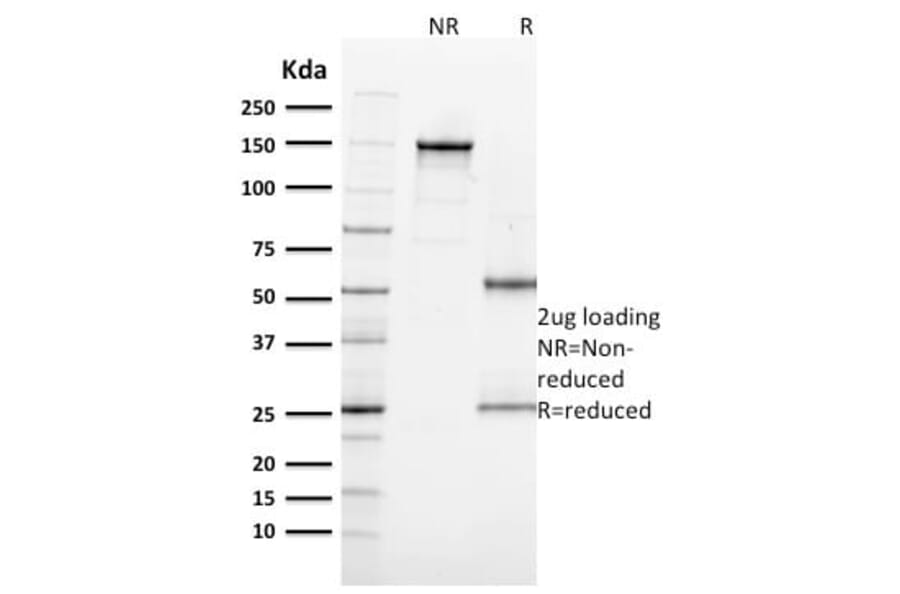 SDS-PAGE - Anti-Ki67 Antibody [MKI67/2462] (CF®740) (A353985) - Antibodies.com