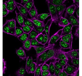 Immunofluorescence - Anti-Ki67 Antibody [MKI67/2462] (CF®488A) (A353986) - Antibodies.com