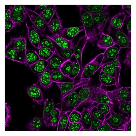 Immunofluorescence - Anti-Ki67 Antibody [MKI67/2462] (CF®488A) (A353986) - Antibodies.com