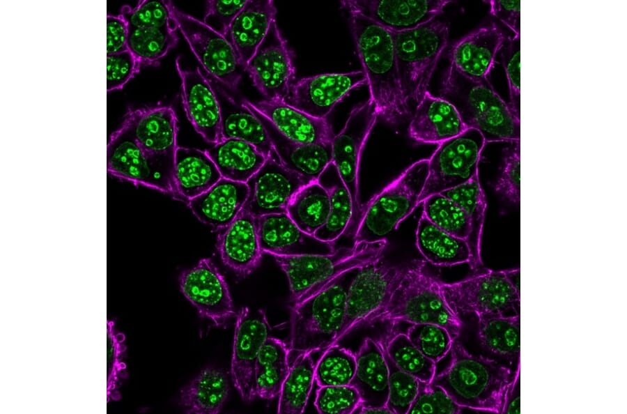 Immunofluorescence - Anti-Ki67 Antibody [MKI67/2462] (CF®594) (A353987) - Antibodies.com