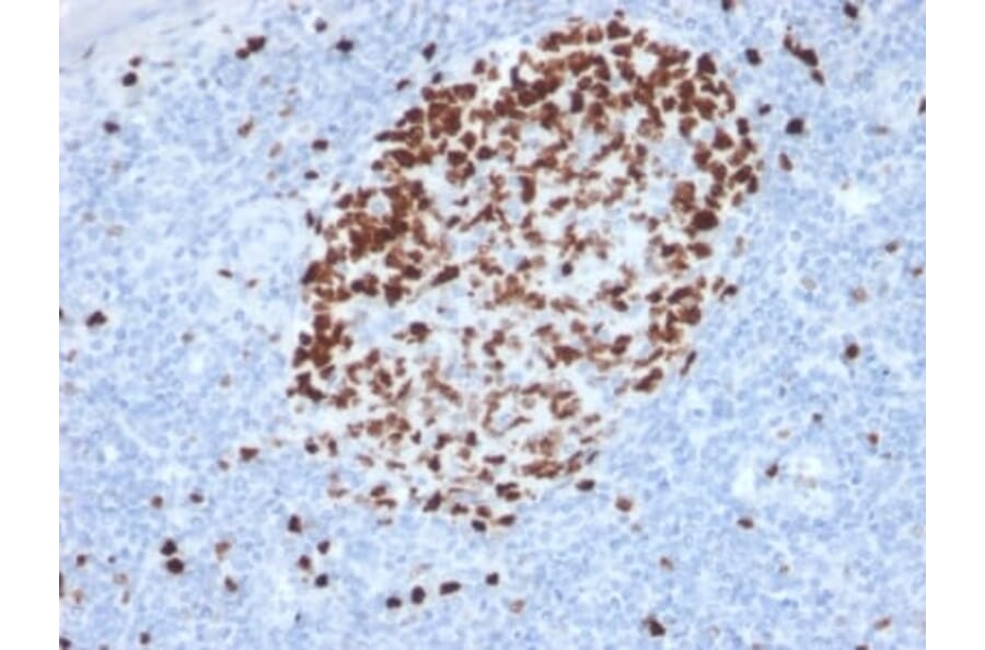 Immunohistochemistry (formalin-fixed, paraffin-embedded) - Anti-Ki67 Antibody [MKI67/2462] (CF®594) (A353987) - Antibodies.com